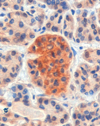 Anti-CCKBR antibody, Internal used in IHC (Formalin-fixed paraffin-embedded sections). GTX89402
