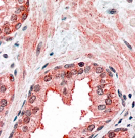 Anti-CCNDBP1 antibody, C-term used in IHC (Formalin-fixed paraffin-embedded sections). GTX15960