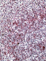 Anti-CD11A / integrin alpha L antibody, Internal used in ELISA. GTX88390