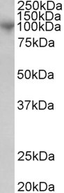 Anti-MS2 / ADAM8 / CD156 antibody, C-term used in Western blot. GTX89928