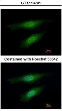 Anti-MSH3 antibody [C2C3], C-term used in ICC/IF. GTX113781