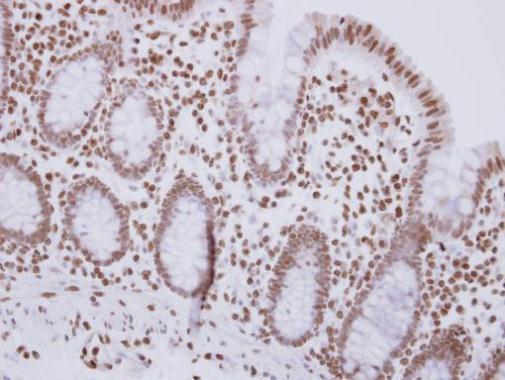 Anti-MSH3 antibody [C2C3], C-term used in IHC (Formalin-fixed paraffin-embedded sections). GTX113781