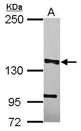 Anti-MSH3 antibody [C2C3], C-term used in Western blot. GTX113781
