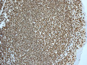 Anti-MSH3 antibody [EPR4334(2)] used in IHC (Formalin-fixed paraffin-embedded sections). GTX63098