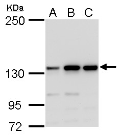 Anti-MSH3 antibody [N1N2], N-term used in Western blot. GTX103228