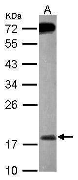 Anti-MSRB2 antibody [N1C3] used in Western blot. GTX119117