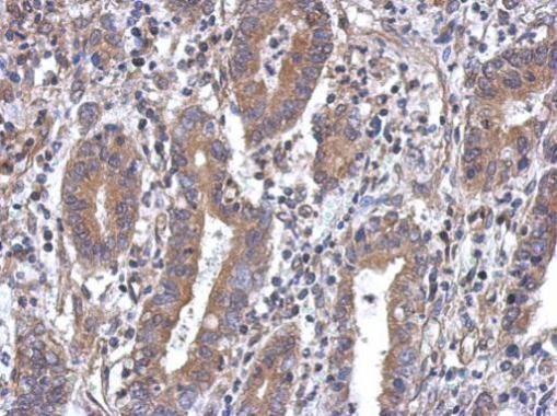 Anti-MTG1 antibody [N1C2] used in IHC (Formalin-fixed paraffin-embedded sections). GTX119864
