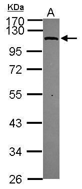 Anti-MTHFD1L antibody [C1C2], Internal used in Western blot. GTX119126