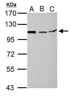 Anti-MTHFD1L antibody [C1C2], Internal used in Western blot. GTX119126