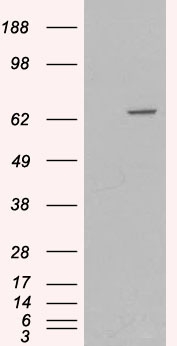 Anti-MTM1 antibody, C-term used in Western blot. GTX89799