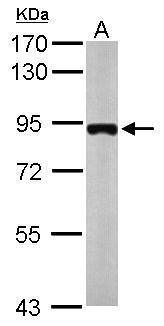 Anti-MTMR12 antibody used in Western blot. GTX119163