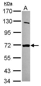 Anti-MTMR8 antibody [C1C3] used in Western blot. GTX120628