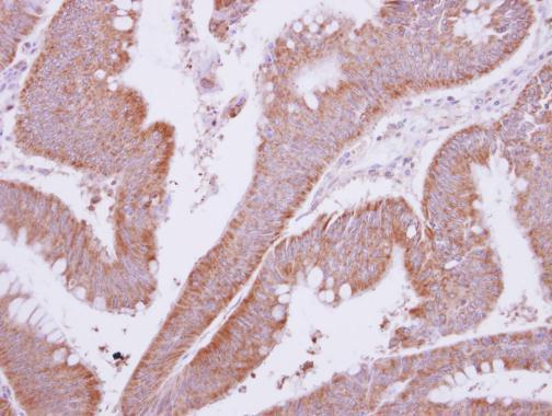 Anti-MTMR9 antibody used in IHC (Formalin-fixed paraffin-embedded sections). GTX118447