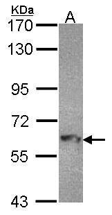 Anti-MTMR9 antibody [C3], C-term used in Western blot. GTX108078