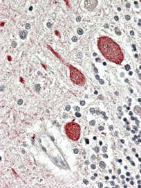 Anti-MTNR1B antibody, C-term used in IHC (Formalin-fixed paraffin-embedded sections). GTX88515