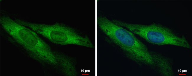 Anti-MTO1 antibody used in ICC/IF. GTX123372