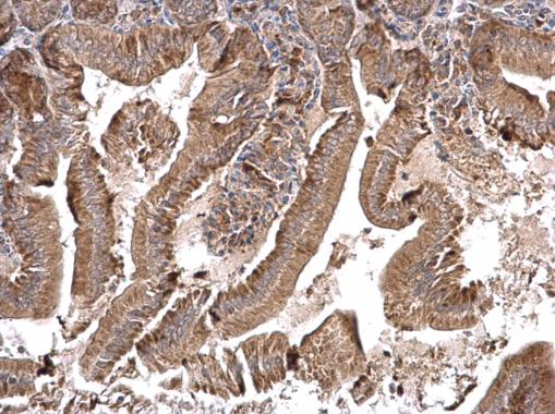 Anti-MTO1 antibody used in IHC (Formalin-fixed paraffin-embedded sections). GTX123372