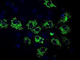 Anti-MTRF1L antibody [1C8] used in ICC/IF. GTX84072
