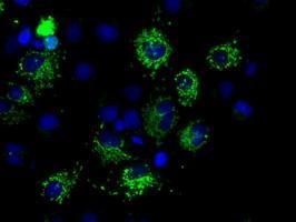 Anti-MTRF1L antibody [1D11] used in ICC/IF. GTX84069