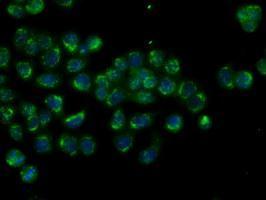 Anti-MTRF1L antibody [1D11] used in ICC/IF. GTX84069