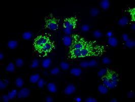 Anti-MTRF1L antibody [1E3] used in ICC/IF. GTX84068