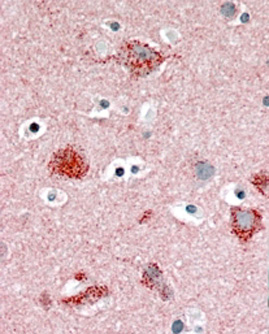 Anti-MUNC18 / STXBP1 (isoform a) antibody, C-term used in IHC (Formalin-fixed paraffin-embedded sections). GTX89288