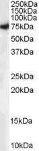 Anti-MUNC18 / STXBP1 (isoform a) antibody, C-term used in Western blot. GTX89288