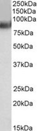 Anti-MURF2 antibody used in Western blot. GTX24387