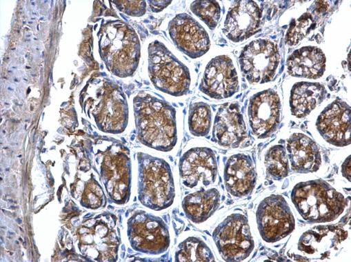 Anti-MVP/LRP antibody used in IHC (Formalin-fixed paraffin-embedded sections). GTX113601