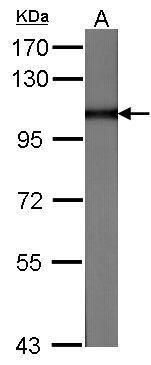 Anti-MVP/LRP antibody [C2C3], C-term used in Western blot. GTX100536