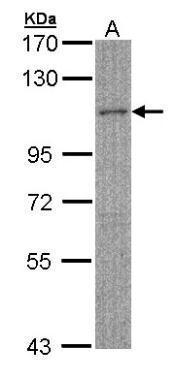 Anti-MYBPC2 antibody [N3C1], Internal used in Western blot. GTX105777