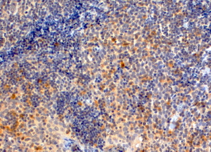Anti-MYD88 antibody, Internal used in IHC (Formalin-fixed paraffin-embedded sections). GTX89605