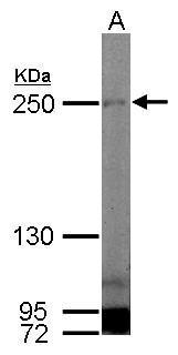 Anti-MYH1 antibody [N1], N-term used in Western blot. GTX119435