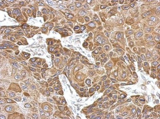 Anti-MYO19 antibody [N1N2], N-term used in IHC (Formalin-fixed paraffin-embedded sections). GTX122503