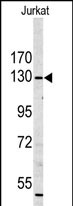 Anti-MYO1A antibody, Internal used in Western blot. GTX81515