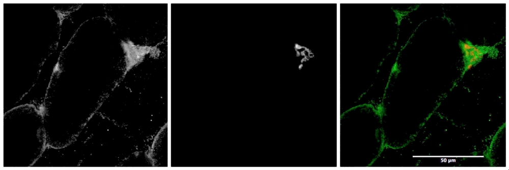 Anti-MYO5A antibody, Internal used in ICC/IF. GTX88050