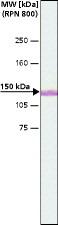 Anti-MYO6 antibody used in Western blot. GTX11096