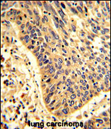 Anti-MyoGEF antibody, N-term used in IHC (Formalin-fixed paraffin-embedded sections). GTX81649