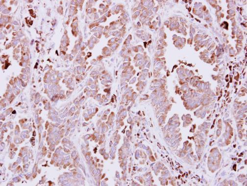 Anti-NAGLU antibody [N3C1], Internal used in IHC (Formalin-fixed paraffin-embedded sections). GTX114569