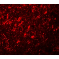 Anti-NALP10 antibody used in ICC/IF. GTX85154