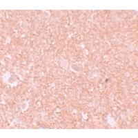 Anti-NALP10 antibody used in Immunohistochemistry. GTX85154
