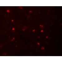 Anti-NALP6 antibody used in ICC/IF. GTX85157
