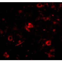 Anti-Nanos3 antibody used in ICC/IF. GTX85389
