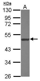 Anti-NARS2 antibody [N1C1] used in Western blot. GTX118096