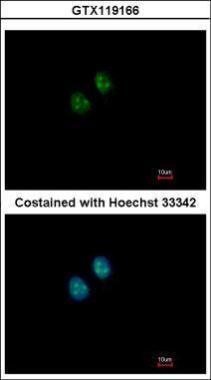 Anti-NAT10 antibody [N1N2], N-term used in ICC/IF. GTX119166