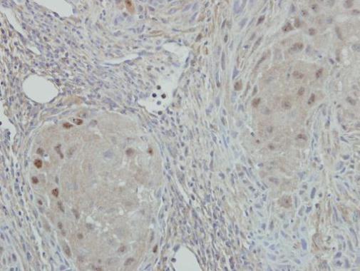 Anti-NAT10 antibody [N1N2], N-term used in IHC (Formalin-fixed paraffin-embedded sections). GTX119166