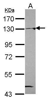 Anti-NAT10 antibody [N1N2], N-term used in Western blot. GTX119166