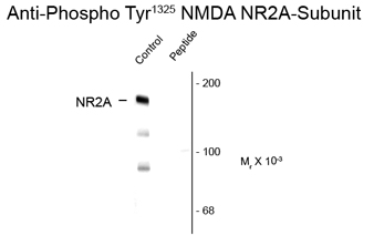 Anti-NDMAR2A (phospho Tyr1325) antibody used in Western blot. GTX82633