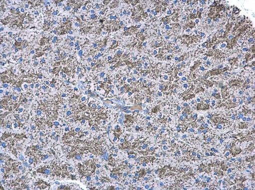 Anti-NDUFAB1 antibody used in IHC (Formalin-fixed paraffin-embedded sections). GTX111875