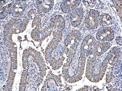 Anti-NDUFAB1 antibody used in IHC (Formalin-fixed paraffin-embedded sections). GTX111875